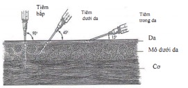 Image removed.